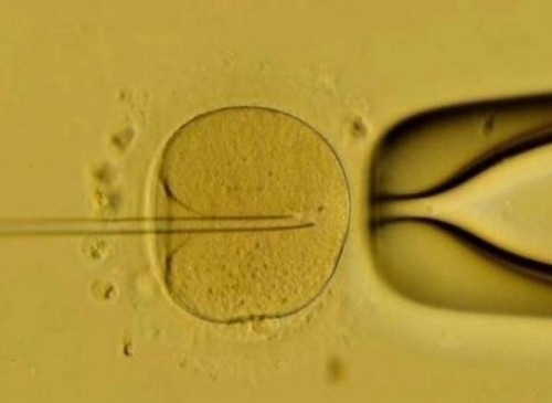 苏州助孕机构：前两胎是女孩第三胎孩子性别是男孩吗，比例只占50%