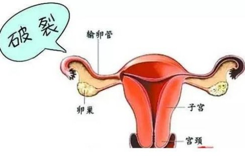 母乳喂养奶水太多怎么办，四招教你有效储存剩余奶水