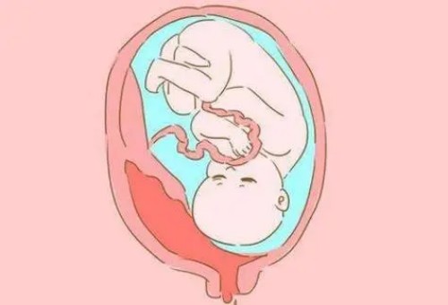 苏州试管助孕公司：不建议女性孕期拔牙，小心引起宫缩和感染危害健康