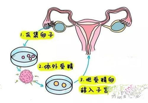 苏州助孕机构：子宫环境差不着床，这些方法帮助你调理