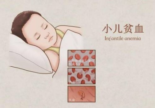 做到这四点帮你远离胎儿窘迫带来的烦恼